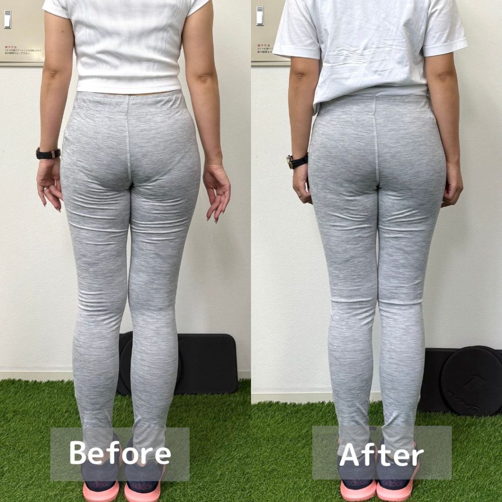 SJ様ビフォーアフター